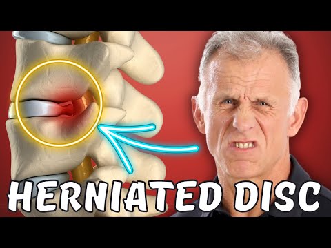 Top 7 Signs You Can Heal Your Own Sciatica/Herniated Disc - UCmTe0LsfEbpkDpgrxKAWbRA