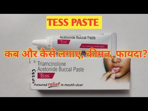Tess Paste l Price, Uses in Hindi l How to Use l Fayde l Triamcinolone Acetonide l
