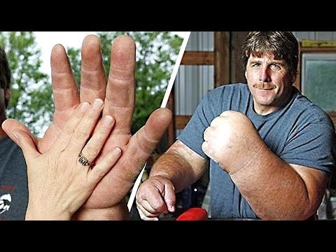 9 People With the Biggest Arms, Feet and More. You Won’t Believe They Are Real - UCYenDLnIHsoqQ6smwKXQ7Hg